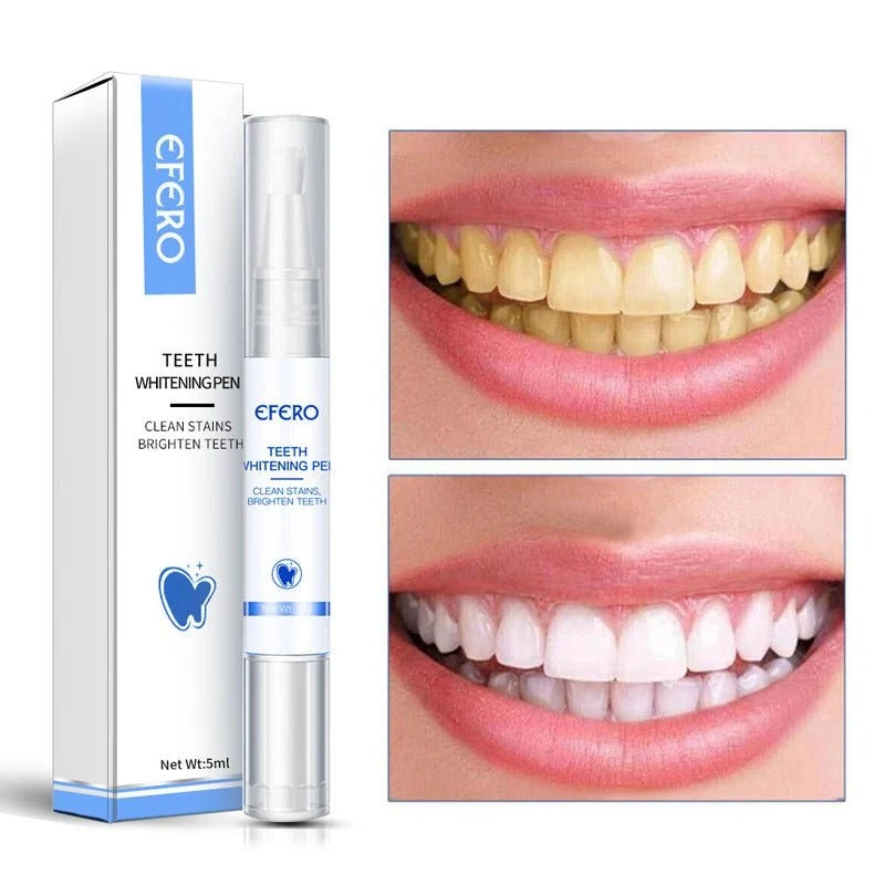 Teeth Whitening Pen Cleaning Serum Remove Plaque Stains Dental Tools Whiten Teeth Oral Hygiene Tooth Whitening Pen Magamall