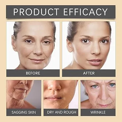 OUHOE - Bee Venom Botox Wrinkle Cream JAMALVIBE