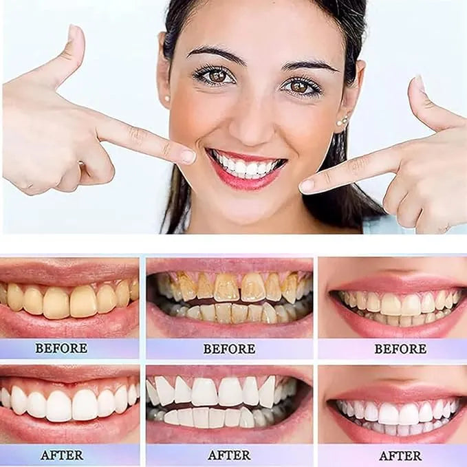 Oralhoe - Nicotinamide Dazzle White Toothpaste JAMALVIBE