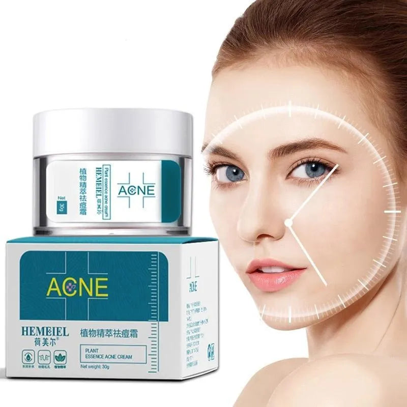Acne Cream My Store